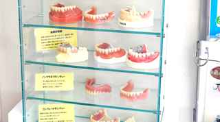 義歯の模型